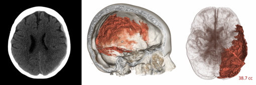 brain scan images